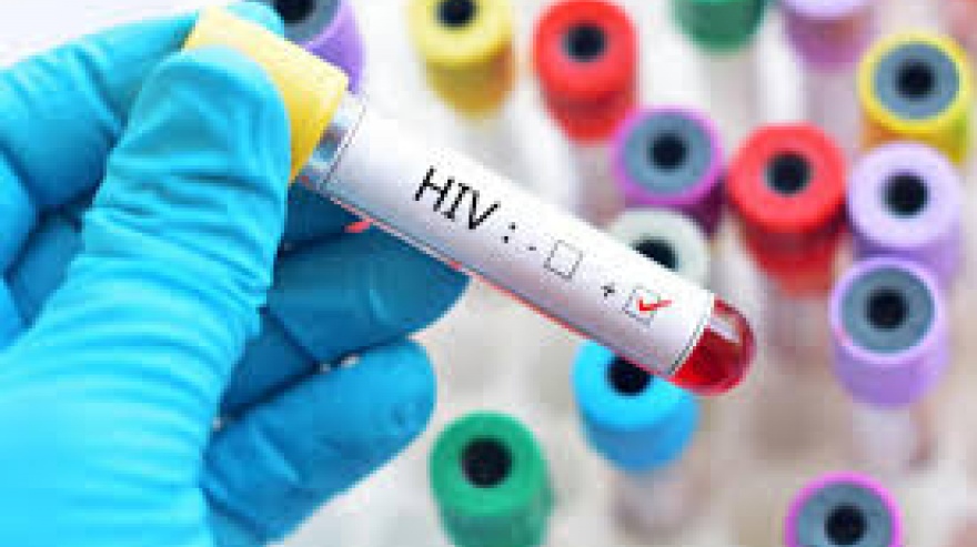 EN LA FUNDACIÓN HUÉSPEDArgentina participará por primera vez de una prueba para una vacuna preventiva de VIH