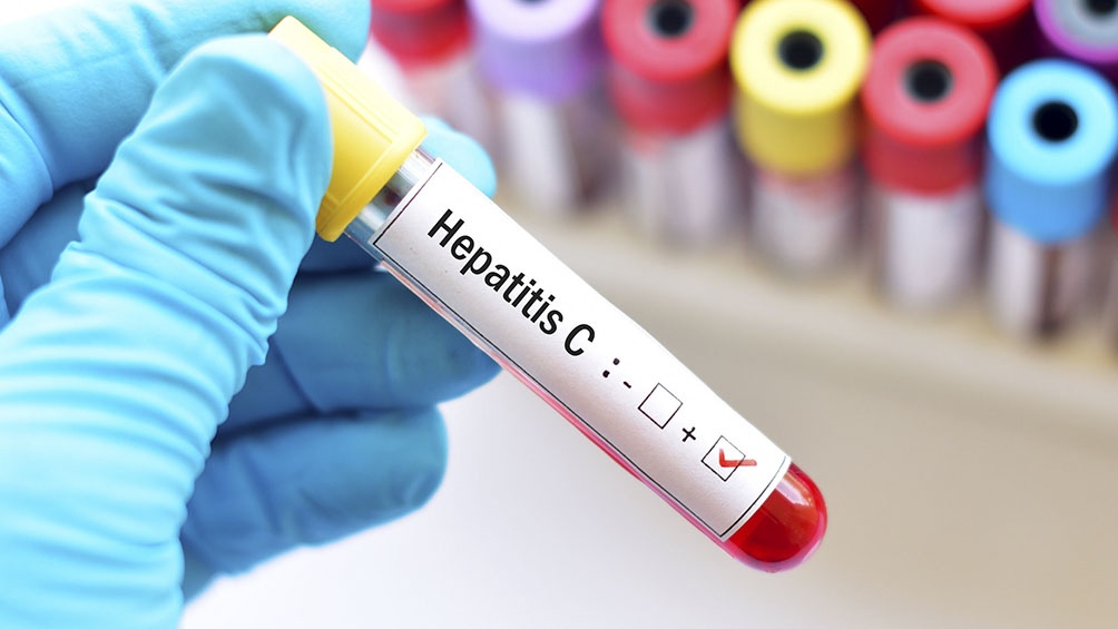 SaludLa hepatitis C ya no es impedimento para donar órganos o recibir un trasplante