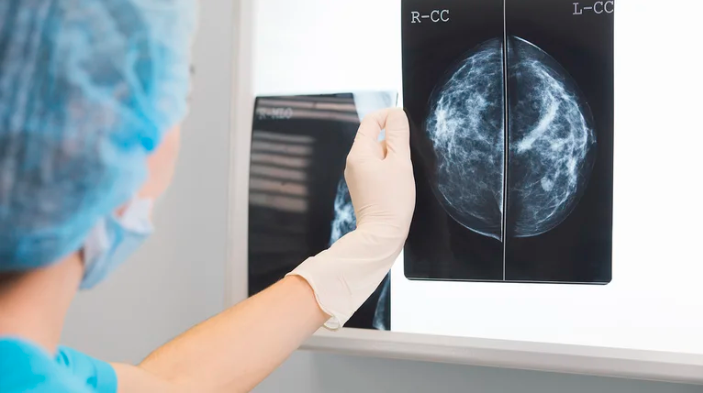SaludUn análisis de sangre permite detectar en forma temprana el cáncer de mama y de próstata
