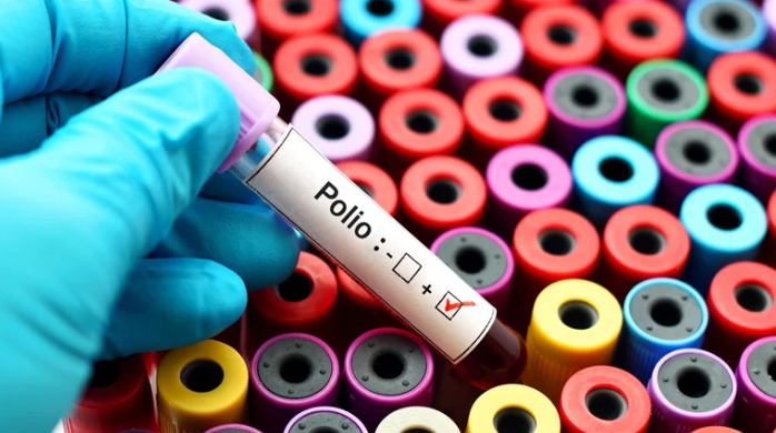 Poliomielitis:Promueven la vacunación infantil por el riesgo de una enfermedad casi erradicada