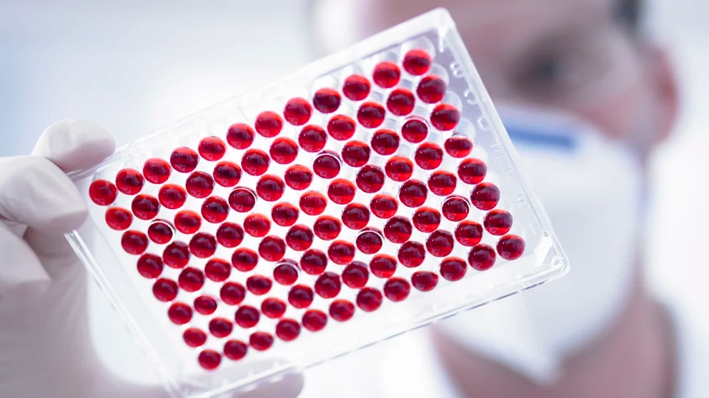 CienciaUn test de sangre durante la infección podría predecir la probabilidad de COVID prolongado
