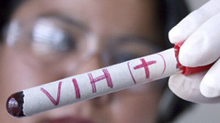 EspañaTercer caso en el mundo de cura del VIH tras un trasplante de células madre