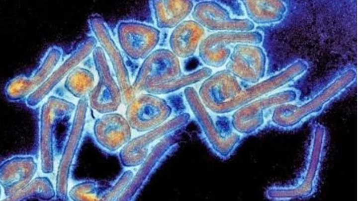 SaludLa OMS confirmó al menos nueve muertos en Guinea Ecuatorial por el primer brote del virus de Marburgo