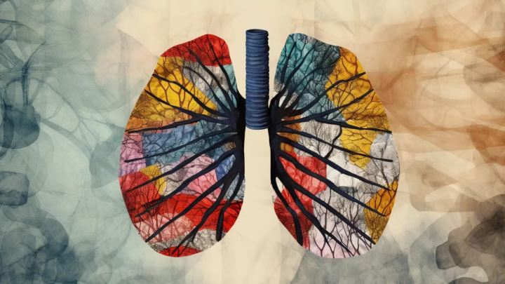SaludCáncer de pulmón: por qué aumentaron los casos y la mortalidad en las mujeres